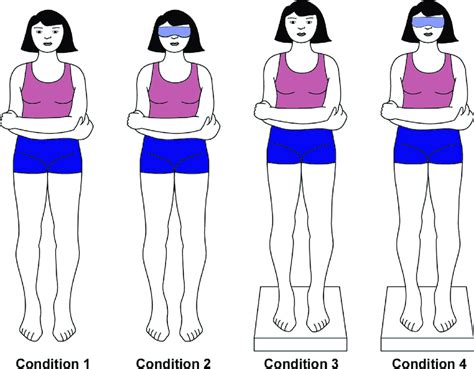 balance compression test|modified romberg balance test.